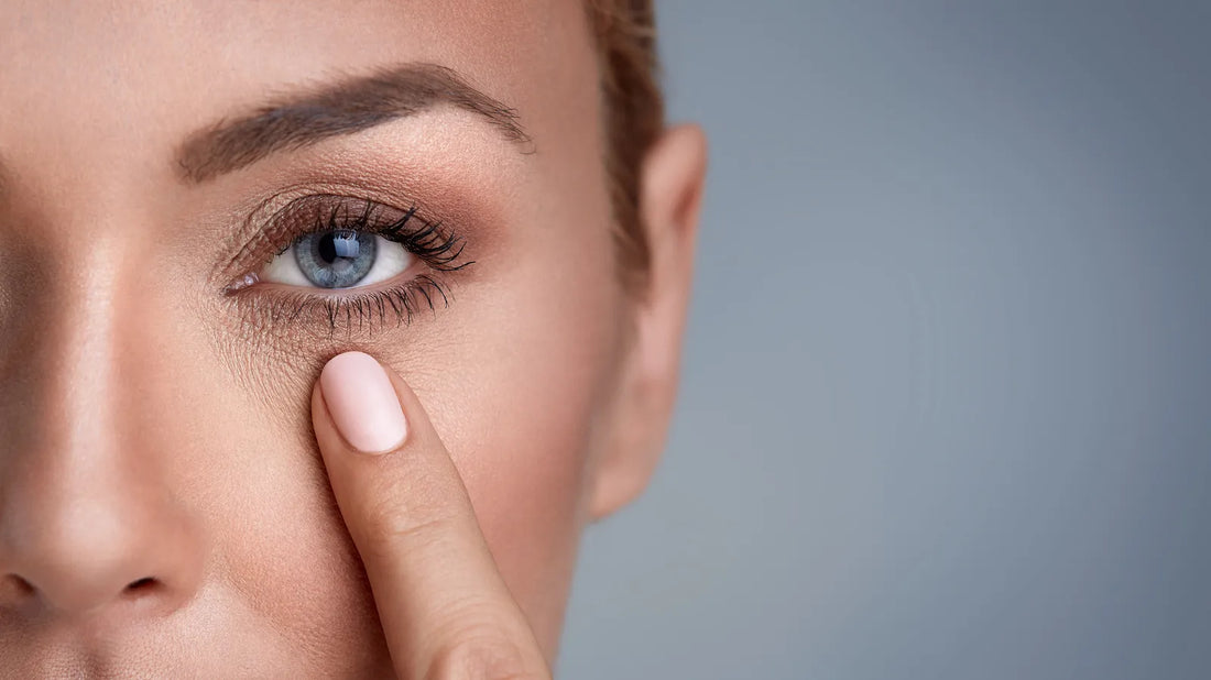 Natural Remedies for Treating Dark Circles